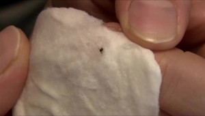 Lymská borelióza je zákerná. Pomôže vám len včasná liečba