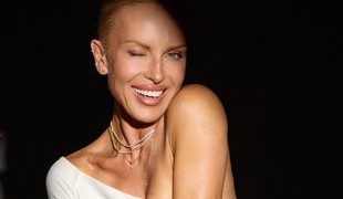 Simona Krainová sa stala terčom posmechu pre neoholené podpazušie: Jej reakcia otvára citlivú tému!