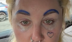 Ako viac sa ešte môže zhovadiť? Pohľad na niekdajšiu hereckú hviezdu vyvoláva ľútosť!