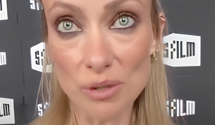 Obavy o zdravie známej herečky: Je za jej vychudnutou tvárou slávna „včelička“?