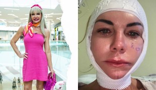 Dôverovala lekárke, zaplatila TVÁROU: Šokujúca spoveď Moniky Nemčokovej z Maniačok!