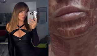 Alexandra Orviská šokovala vzhľadom po zákroku: TVÁR ako z hororu! TOTO fakt dala?!