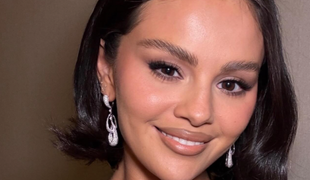 Selena Gomez prekvapila zmenou: Naozaj podstúpila drastickú plastickú operáciu?