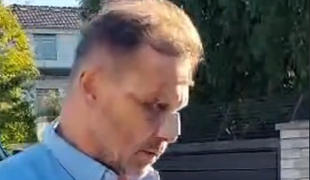 To snáď nie! Soukup má jasno, KTO a PREČO na neho poslal útočníkov s baseballkami!