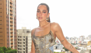 Dua Lipa a jej nečakaný dar pre Ukrajinu: Zachráni stovky životov!