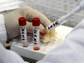 Objav, ktorý zmení naše žitie. Vedci dokázali obnoviť cirkuláciu krvi na 36 hodín