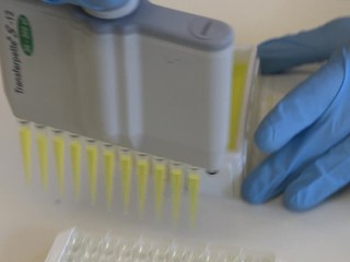 Môžeme vyrábať vakcínu proti Covid -19 aj na Slovensku? Potrebujeme pár mesiacov