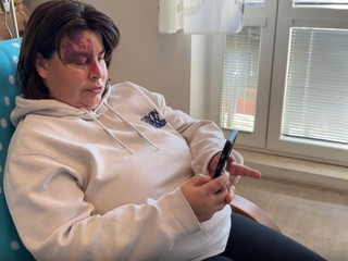Z lekára a vdovca zo Sýrie sa vykľul podvodník. Pani Lucia prišla o takmer 9-tisíc eur