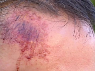 Tomáš sa s rodinou vybral vinšovať zdravie svojim rodičom. Cestou k nim ho zbili