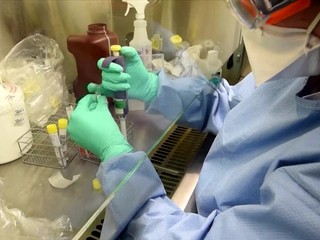 List chirurga z Bergama: Pracovná doba už neexistuje. Pre nás je osobný život pozastavený