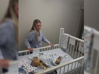 Chlapček po pôrode zožltol a páchol hnilobou. Matka mu zachránila život