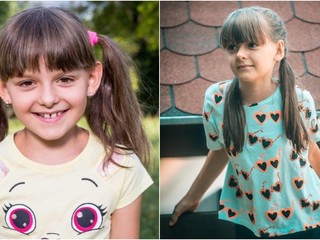 Z dievčatka mladá žena: TAKTO dnes vyzerá Anežka zo seriálu Prázdniny!