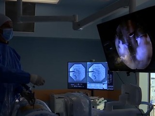 Unikátna operácia na Slovensku:  Endoskopický zákrok vyskočenej platničky