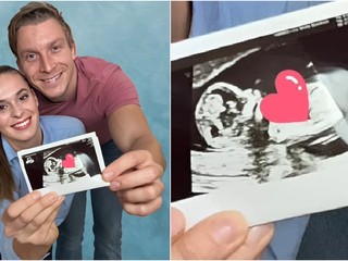 Budúca mamička Dominika Richterová konečne ukázala bruško: Pozrite, aká je krásna tehuľka!
