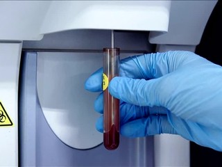 Odhalili globálnu dopingovú sieť. Schmidt skončil v putách