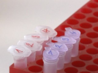 Toto sa deje so vzorkami infekcie koronavírusu, ktoré putujú do SAV