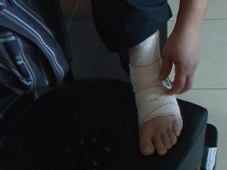 Vytkli ste si členok? Ak počujete tento zvuk, určite sa neliečte sami!