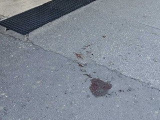 Petra pobodal útočník v centre Bratislavy. Dotackal sa pred známy bar, pomohli mu ochrankári
