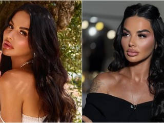 Úžasná premena Zuzany Plačkovej: Pamätáte si, ako vyzerala, keď súťažila v Maniačkach?