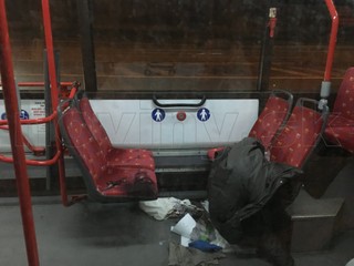 V Bratislave zachraňovali ženu obliatu kyselinou