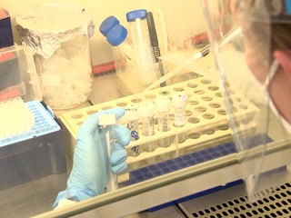 Platnosť PCR testu sa nemeria od doručenia výsledku, ale dňa odberu. Pozrite si prehľad platných vyhlášok