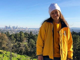 Šesť rokov si neumývala vlasy: Povedali by ste to o nej?