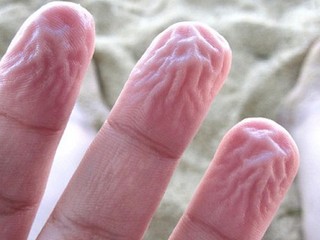 Milujete dlhý kúpeľ? Neuhádnete, prečo vám vráskavejú prsty vo vode