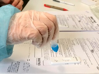 Nový režim v nemocniciach a zmena v testovaní: Pozrite si prehľad aktuálnych pandemických opatrení