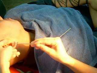 Svrbia vás často uši? Toto je 6 najčastejších dôvodov