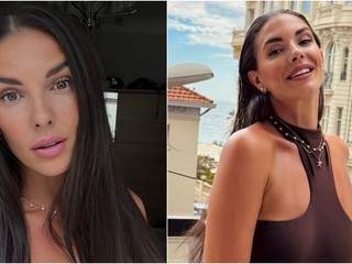Soňa Skoncová otvorene o prirodzenosti a sebaláske: Botox odmieta, nefarbí si ani vlasy!