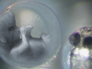 Vedci v USA prvýkrát opravili chybný gén ľudského embrya