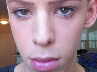 Už ako tínedžer bol iný: Chalan podstúpil viac ako 100 zákrokov, strasie vás, ako vyzerá