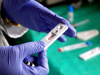 Na svete je druhý vyliečený z HIV, oznámili lekári