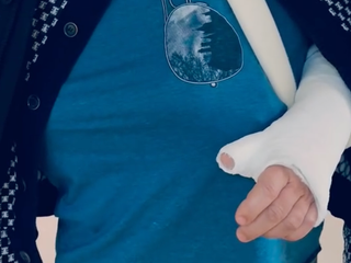 Lyžovačka skončila zle pre známeho českého režiséra! Má dolámané obe ruky!