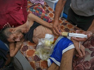 Gaza čelí zámernému hladomoru, varuje OSN. Počet podvyživených detí alarmujúco rastie