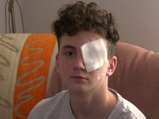 Jedna petarda mu zmenila život: Martin varuje pred nebezpečenstvom zábavnej pyrotechniky