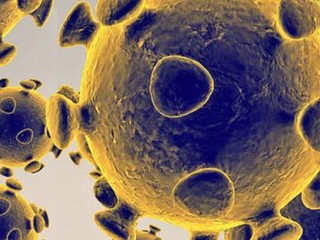 Šport počas zákazu vychádzania. Ako to budú riešiť reprezentanti?