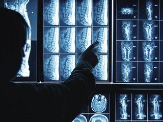 Dvetisíc ľudí je bez lekára. V dvoch obciach ordinuje jeden