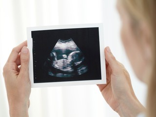 Zvažujú register pre ženy, ktoré stratili panenstvo. Psychológovia hovoria o vlne samovrážd