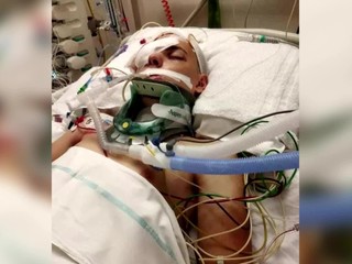 Telefonát, ktorý nechce zažiť žiadna matka. Nadi zavolali, že jej syn spadol z 10 metrovej výšky