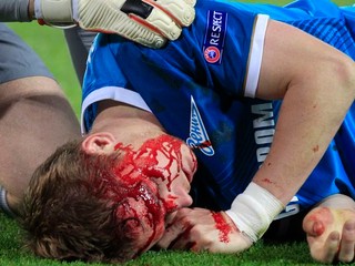 VIDEO. Van Persie s hetrikom, Hubočan s krvavou hlavou