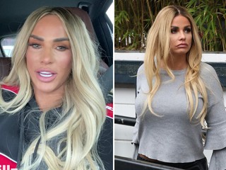 Najznámejšia britská modelka predáva svoje použité prsné implantáty: Neuhádnete, za koľko