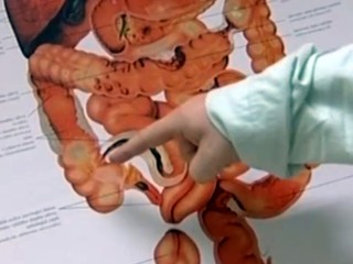 Trápi vás NADMERNÁ PLYNATOSŤ? Môže byť príznakom až 8 chorôb postihujúcich črevá!