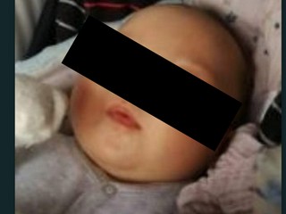 Štvormesačný Tadeáš nezomrel násilnou smrťou. Išlo o nešťastnú náhodu