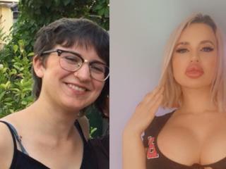 Z priemerného dievčaťa sa zmenila na silikónovú umelinu: Fotky pred a po