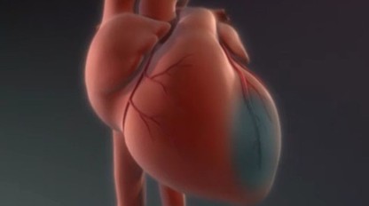 Infarkt u ženy môže vyzerať úplne inak než u muža : Na tieto príznaky si dajte pozor!