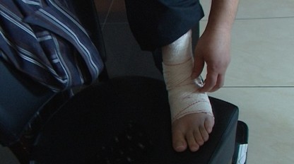 Vytkli ste si členok? Ak počujete tento zvuk, určite sa neliečte sami!