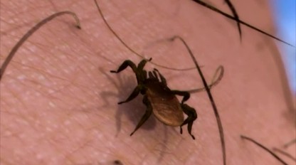 5 otázok a odpovedí o lymskej borelióze:  Aj keď sa nakazíte, ochorieť nemusíte