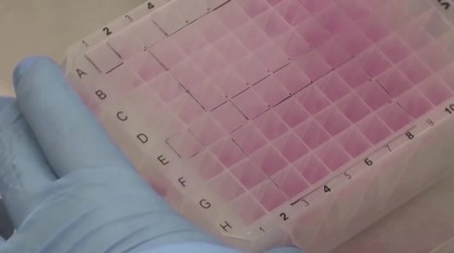 Na Slovensku potvrdili 5 prípadov opičích kiahní