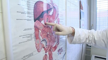 Až 40 percent Slovákov trpí touto nákazou: Máte aj vy INFEKCIU, KTORÁ NIČÍ TRÁVENIE?